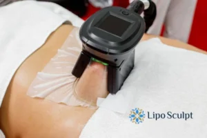 Cryolipolysis Helping You Getting that Perfect Summer Body 3 Cryolipolysis Great Baddow can give you the best summer body - contact us today!