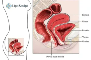 Treatment For A Leaky Bladder 2 How EM Chair treatment Great Baddow can help Leaky bladder issues. Read more now!